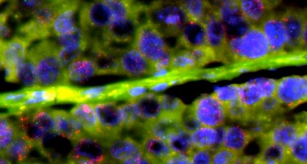 biopsia liquida